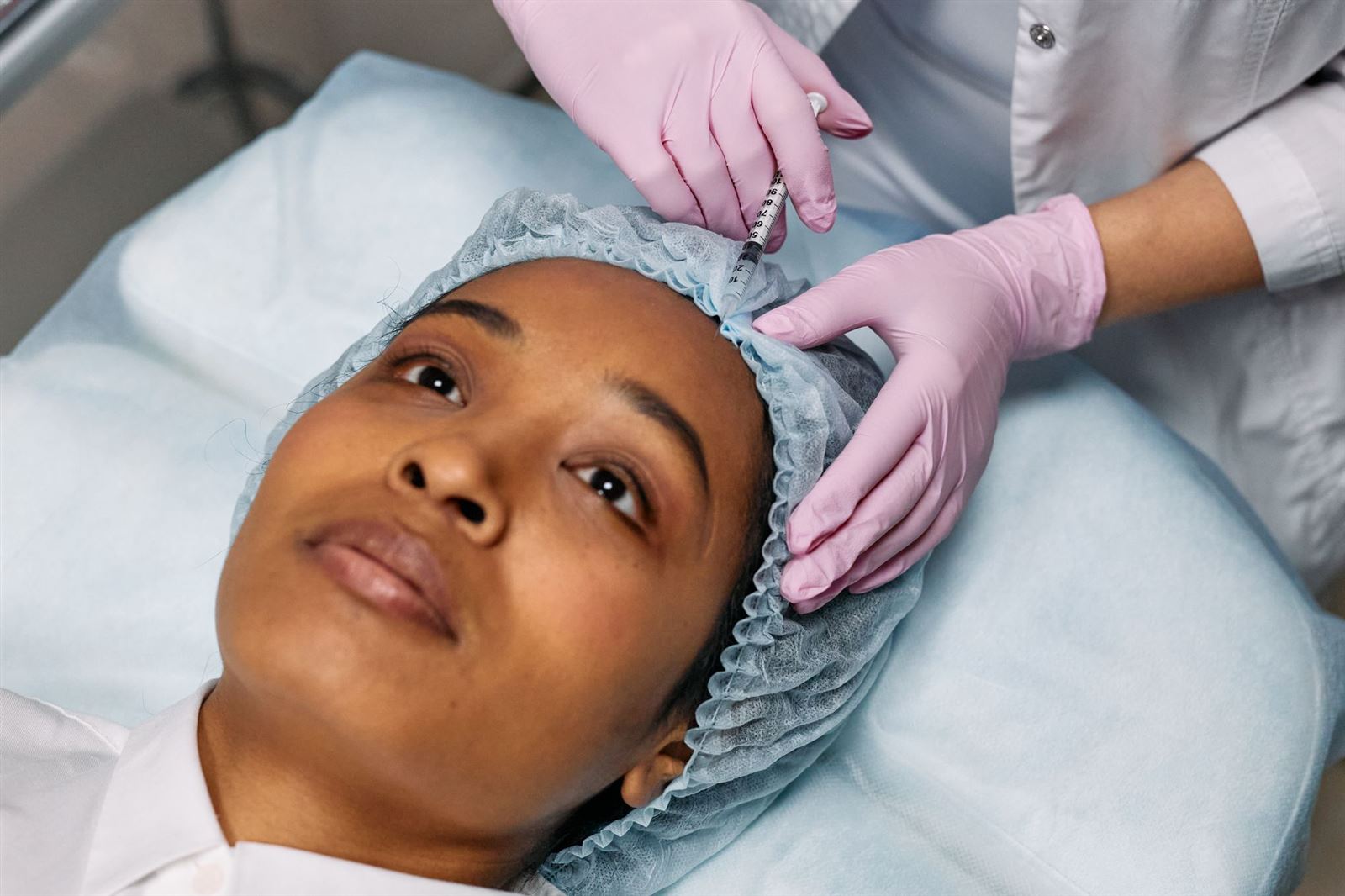 Aplicación de mesoterapia capilar sobre el cuero cabelludo