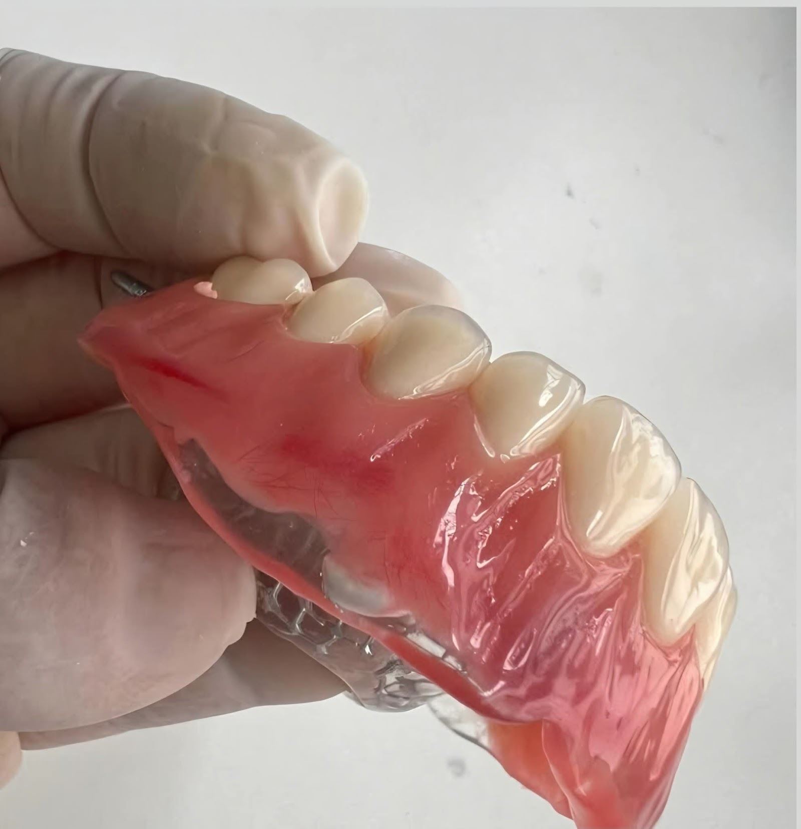 Prótesis dental fabricada en el laboratorio propio de Rovaldent